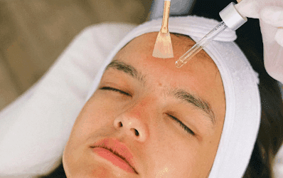 Looking for the Best Skin Clinic in Perth? Here’s Why Locals Choose The Skin Nurse